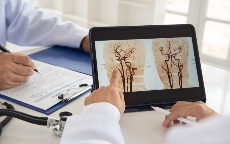 peste-65.000-de-pacienti-cu-accident-vascular-cerebral-ischemic-au-fost-tratati-in-cadrul-programului-national-de-urgenta-pentru-avc